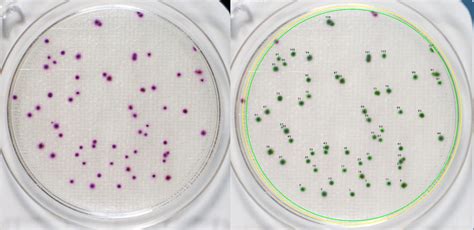 The Crucial Role of CFU count in Bacteria Culture for Water Treatment - Purewater Enterprises ...