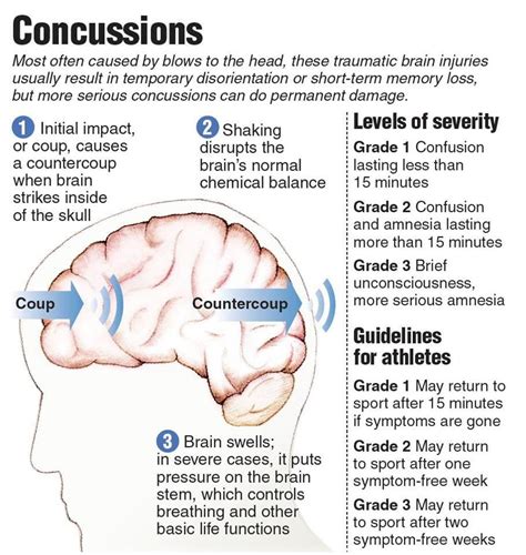 Types Of Hematoma In Head Injury - Peter Brown Bruidstaart