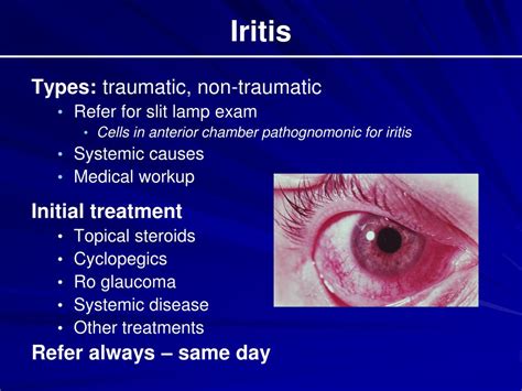 PPT - The Red Eye and Selected Ocular Emergencies PowerPoint Presentation - ID:5640470