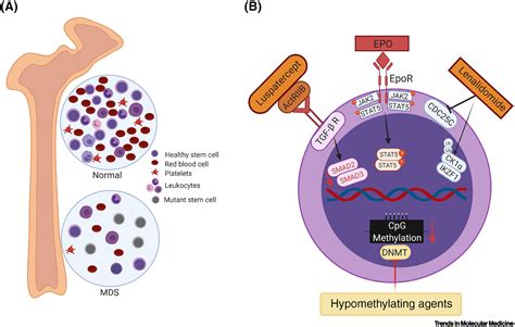 Targeting low-risk myelodysplastic syndrome with novel therapeutic strategies: Trends in ...