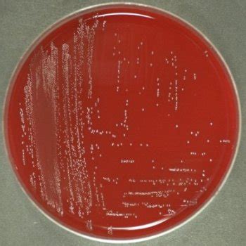 Enterococcus faecium