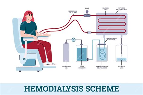 Hemodialysis Diagram