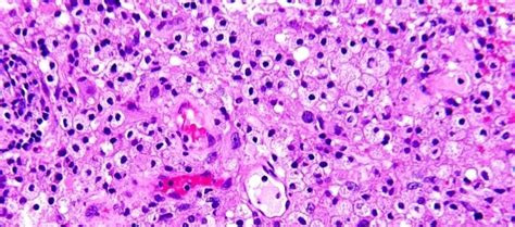 Hematoxylin and Eosin staining : Principle, Procedure and Interpretation - Laboratoryinfo.com