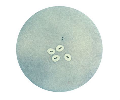 Difference Between Capsule and Slime Layer | Structure, Characteristics ...