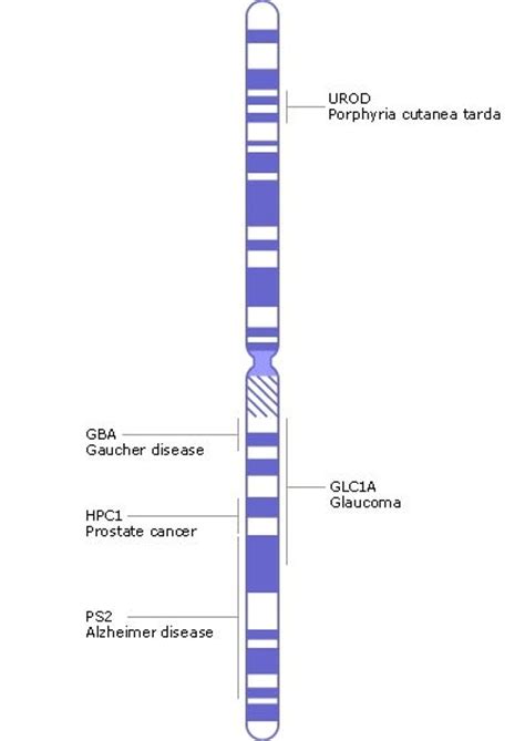 46 best Chromosomes, genes, 1q21.1 deletion images on Pinterest | Genetics, Gout and Base