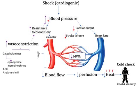 Cardiogenic Shock Pathophysiology Diagram