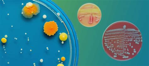 Learn Bacterial Colony Morphology 101 | Hudson Robotics