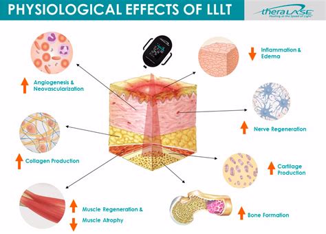 Low Level Laser Light Therapy Side Effects | Shelly Lighting