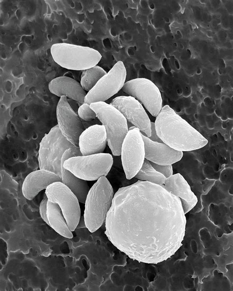 Parasitic Protozoan Tachyzoites Photograph by Dennis Kunkel Microscopy/science Photo Library ...