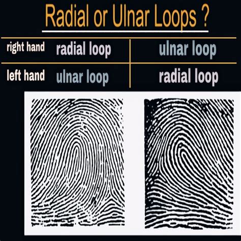 Fingerprint Analysis: Ulnar Loop or Radial Loop