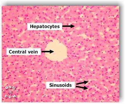 Histology - Liver - lobule with central vein - Sinusoids are larger than conventional ...