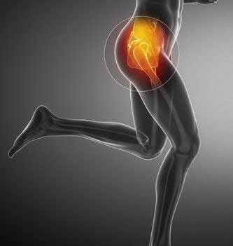 GREATER TROCHANTERIC PAIN SYNDROME :CUASES&TREATMENT