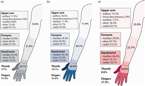 Ulnar Nerve Injury