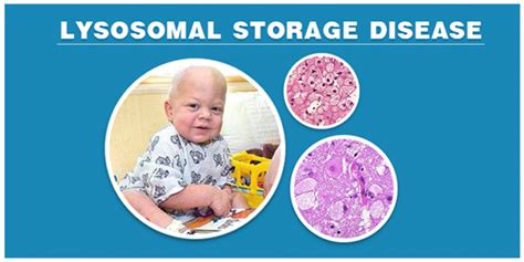 Lysosomal Storage Disease -Types, Symptoms, Causes and its Treatment