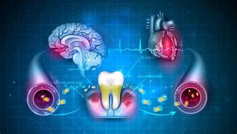 Systemic diseases associated with gum diseases - Best Dental Clinic In Bangalore Indiranagar ...