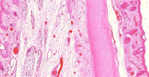 Elastic Cartilage Histology