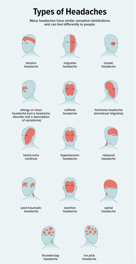 Types of Headaches - MEDizzy