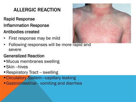 PPT - Allergic Reactions Anaphylaxis PowerPoint Presentation, free download - ID:5635354