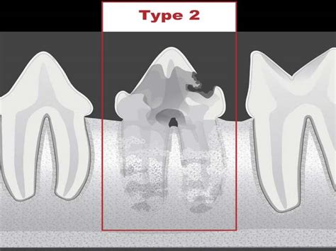 Feline dental disease｜Tooth Resorption in cat - Wellnessvet