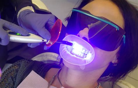 Is There a Link Between UV Light Teeth Whitening and Cancer? - Dental Health Society