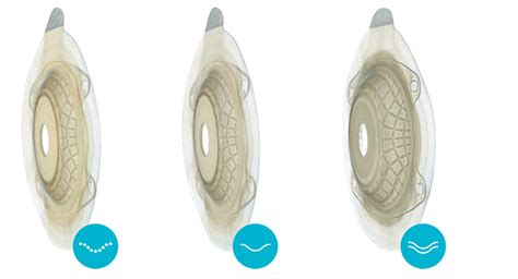 Convex Flanges: How to Choose and Use Them for Ostomy Patients ...