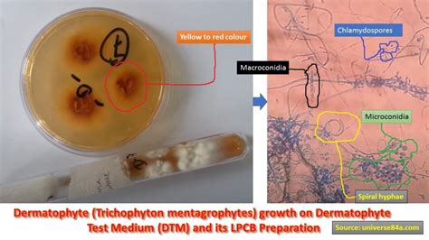 Dermatophyte Test Medium (DTM): Introduction, Principle, Composition