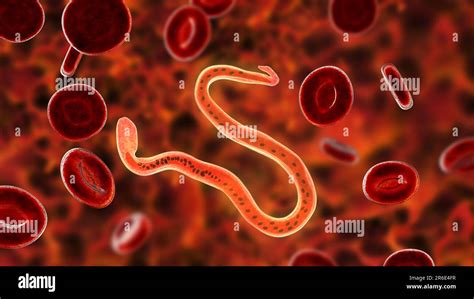 Wuchereria bancrofti. Computer illustration of the microfilaria larval stage of the parasitic ...