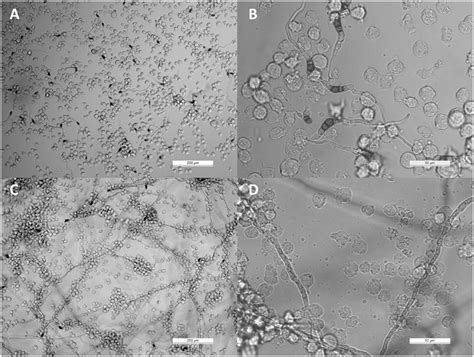 Frontiers | Interaction of THP-1 Monocytes with Conidia and Hyphae of ...