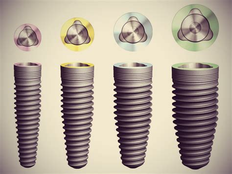 IMPLANTOLOGY: Nobel Biocare Dental Implant Systems for Oral Rehabilitation