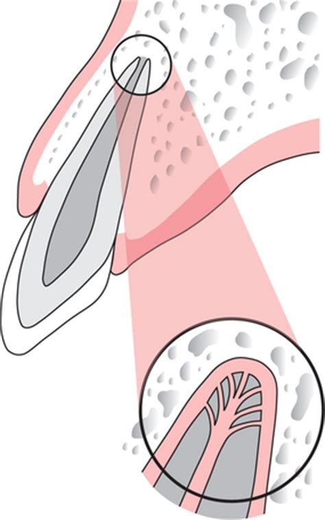 6: Surgical endodontics | Pocket Dentistry