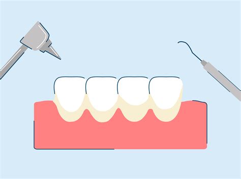 What Causes Tartar on Teeth?