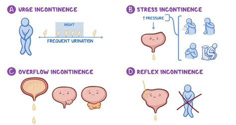 Bladder and bowel training: Clinical skills notes | Osmosis