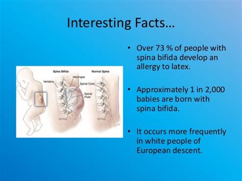 Top 3 causes and symptoms of spina bifida