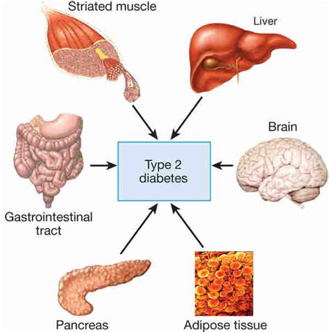 Low Blood Sugar Symptoms: High Blood Sugar Symptoms List