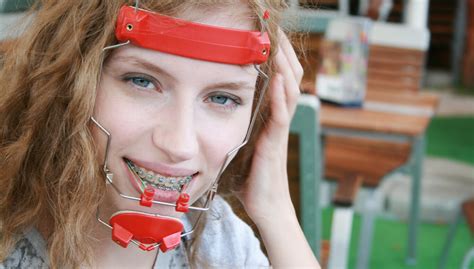 Here's How Headgear Can Improve Your Child's Smile | 20 Mile Orthodontics