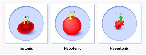 Hypertonic Solution - Definition and Examples | Biology Dictionary ...