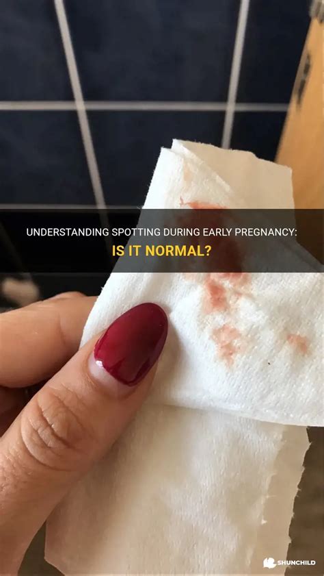 Understanding Spotting During Early Pregnancy: Is It Normal? | ShunChild