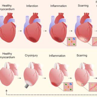 Immune cell population and ECM dynamics during zebrafish cardiac... | Download Scientific Diagram