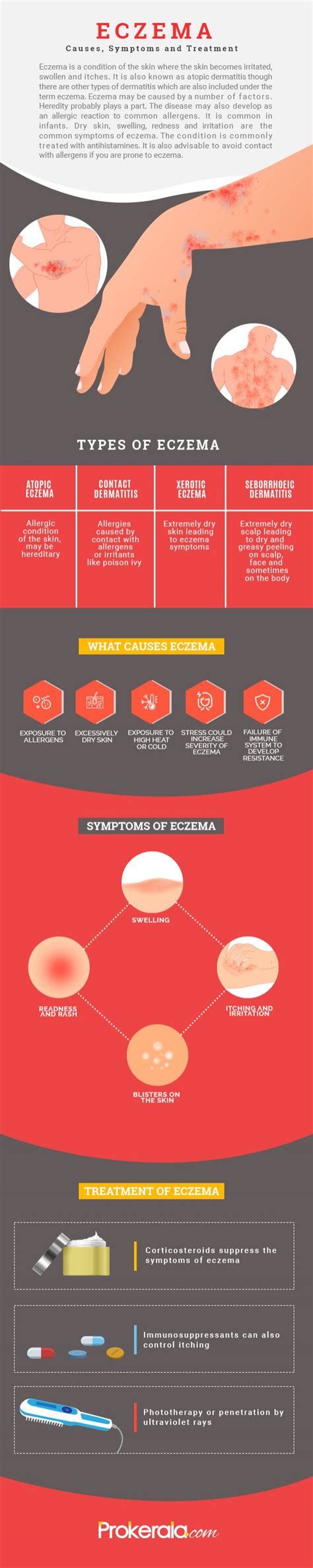 Eczema - causes, symptoms and natural remedies | Ayurvedic treatment for Eczema