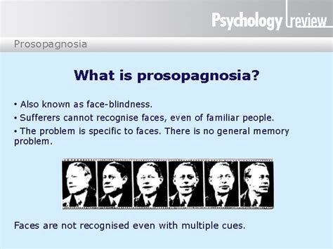 Prosopagnosia Prosopagnosia What is prosopagnosia Also known as