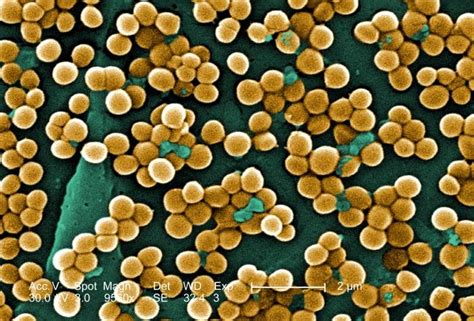 Bai-To-EY: การศึกษาการยับยั้งการเจริญเติบโตของแบคทีเรีย staphylococcus aureus ด้วยสารสกัดสมุนไพร