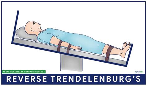 Why Would You Put A Patient In Reverse Trendelenburg Position? | ICU ...