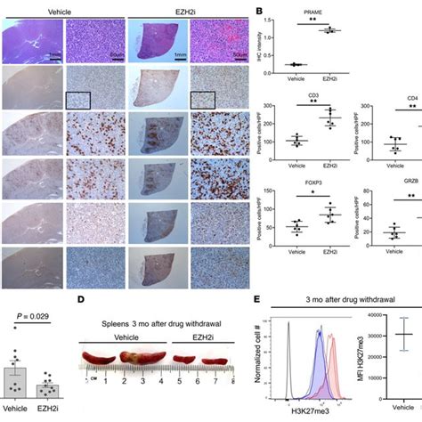 Discovery and clinical impact of PRAME deletion in DLBCL. (A ...