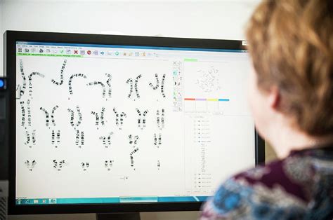 Genetic Karyotype Analysis Photograph by Arno Massee | Fine Art America