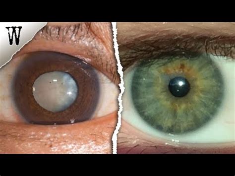 Signs of EYE COLOR ANCESTRY You Shouldn't Ignore - YouTube