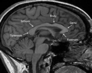 Splenium Function