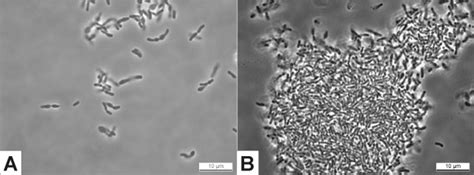 A: Microscopic picture of Bifidobacterium RBL67 grown on MRS-C agar ...