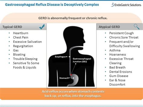 Acid Reflux Evaluation