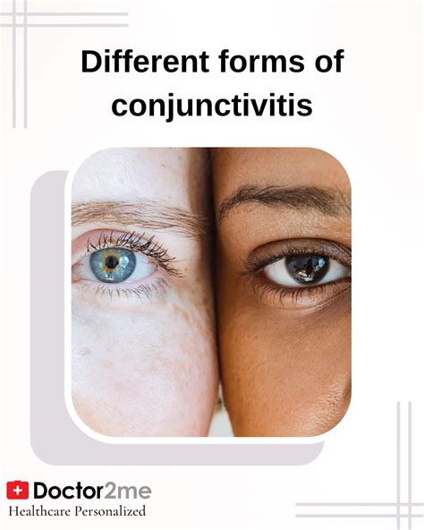 Different forms of conjunctivitis - treatment- prevention-symptoms ...