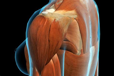 Deltoid pain: Causes, exercises, and relief